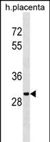 Mouse Monoclonal Antibody to OR5B12