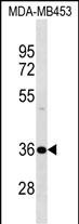 Rabbit Polyclonal Antibody to DNAJB2 (N-term)