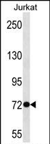 Rabbit Polyclonal Antibody to ANKRD56