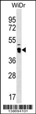 Rabbit Polyclonal Antibody to ATAD3C
