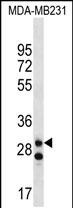 Rabbit Polyclonal Antibody to LRRC3C