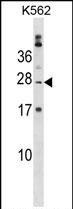 Rabbit Polyclonal Antibody to PABPC1L2B
