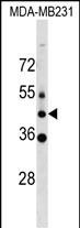 Rabbit Polyclonal Antibody to MLC1