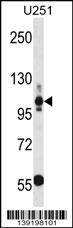 Rabbit Polyclonal Antibody to THBS3 (N-term)