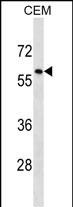 Rabbit Polyclonal Antibody to TRIM58
