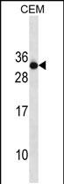 Rabbit Polyclonal Antibody to RAB4B (N-term)