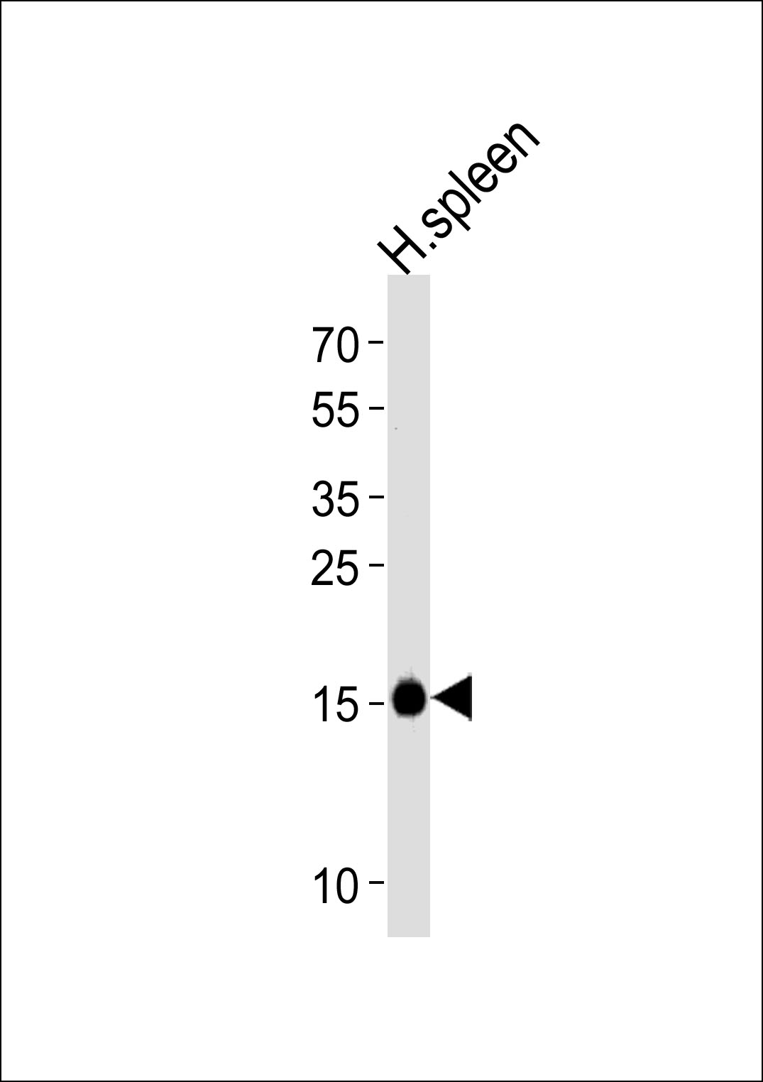 Rabbit Polyclonal Antibody to RNASE2
