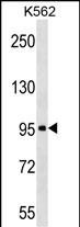 Rabbit Polyclonal Antibody to ABI3BP