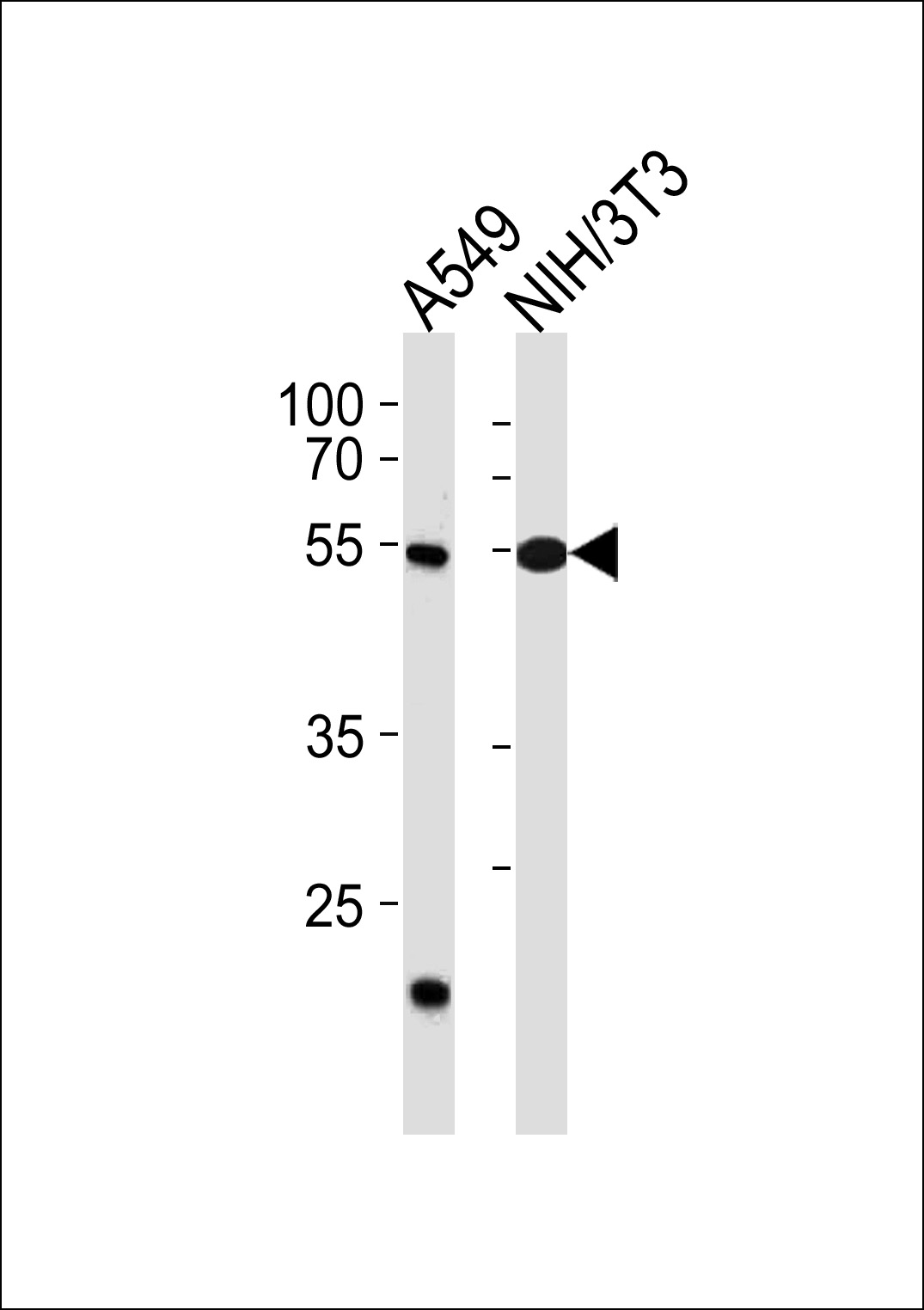 Rabbit Polyclonal Antibody to TBX4 (N-term)