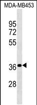 Rabbit Polyclonal Antibody to PSG4 (N-term)