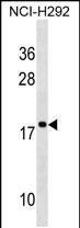 Rabbit Polyclonal Antibody to RPS17L
