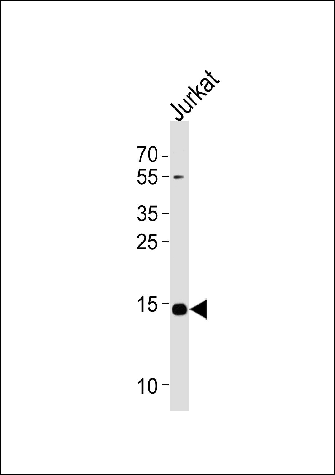 Rabbit Polyclonal Antibody to UBE2D4
