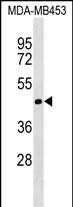 Rabbit Polyclonal Antibody to TIMM50 (N-term)