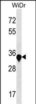 Rabbit Polyclonal Antibody to AMMECR1