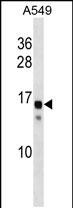 Rabbit Polyclonal Antibody to SSX11 (N-term)