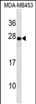 Rabbit Polyclonal Antibody to TRDC