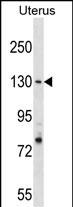 Rabbit Polyclonal Antibody to RFC1 (N-term)