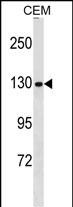Rabbit Polyclonal Antibody to NCAPG (N-term)