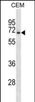 Rabbit Polyclonal Antibody to ACCN3 (N-term)