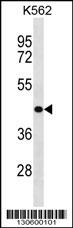 Rabbit Polyclonal Antibody to ZNF73 (N-term)
