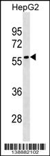 Rabbit Polyclonal Antibody to LRRC69