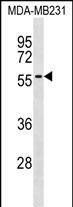 Rabbit Polyclonal Antibody to AKAP5