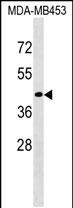 Rabbit Polyclonal Antibody to CD200R1L (N-term)