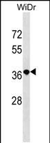Rabbit Polyclonal Antibody to RN3L1