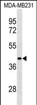Rabbit Polyclonal Antibody to LRRC39 (N-term)