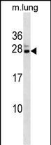 Rabbit Polyclonal Antibody to Mouse Cbx5