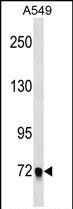 Rabbit Polyclonal Antibody to EPB41L5