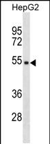 Rabbit Polyclonal Antibody to TMPPE