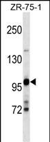 Rabbit Polyclonal Antibody to ULK2 (Center S323)