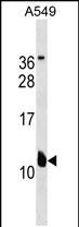 Rabbit Polyclonal Antibody to KCNE2