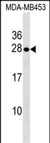 Rabbit Polyclonal Antibody to SPINT2