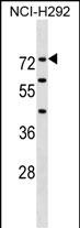Rabbit Polyclonal Antibody to F12 (N-term)