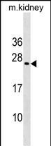 Rabbit Polyclonal Antibody to MIXL1
