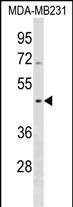 Rabbit Polyclonal Antibody to SEPT12