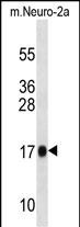 Rabbit Polyclonal Antibody to Mouse Rpl13a (N-term)