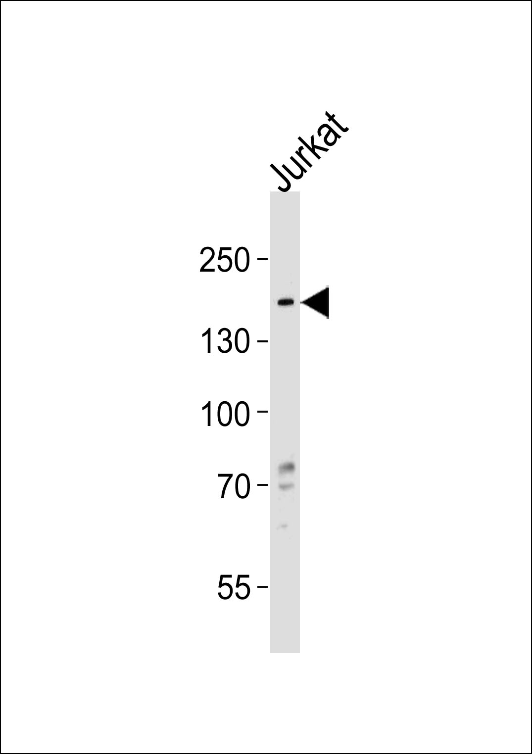 Rabbit Polyclonal Antibody to HMGXB3