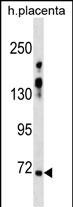 Rabbit Polyclonal Antibody to ZNF251 (N-term)