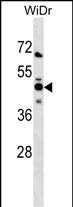 Rabbit Polyclonal Antibody to NMI (N-term)