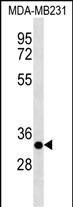Rabbit Polyclonal Antibody to CAPNS2