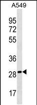 Rabbit Polyclonal Antibody to PEBP4