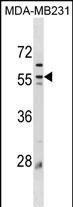 Rabbit Polyclonal Antibody to Mouse Plin3(C-term)
