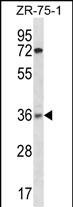 Rabbit Polyclonal Antibody to XRCC2(N-term)