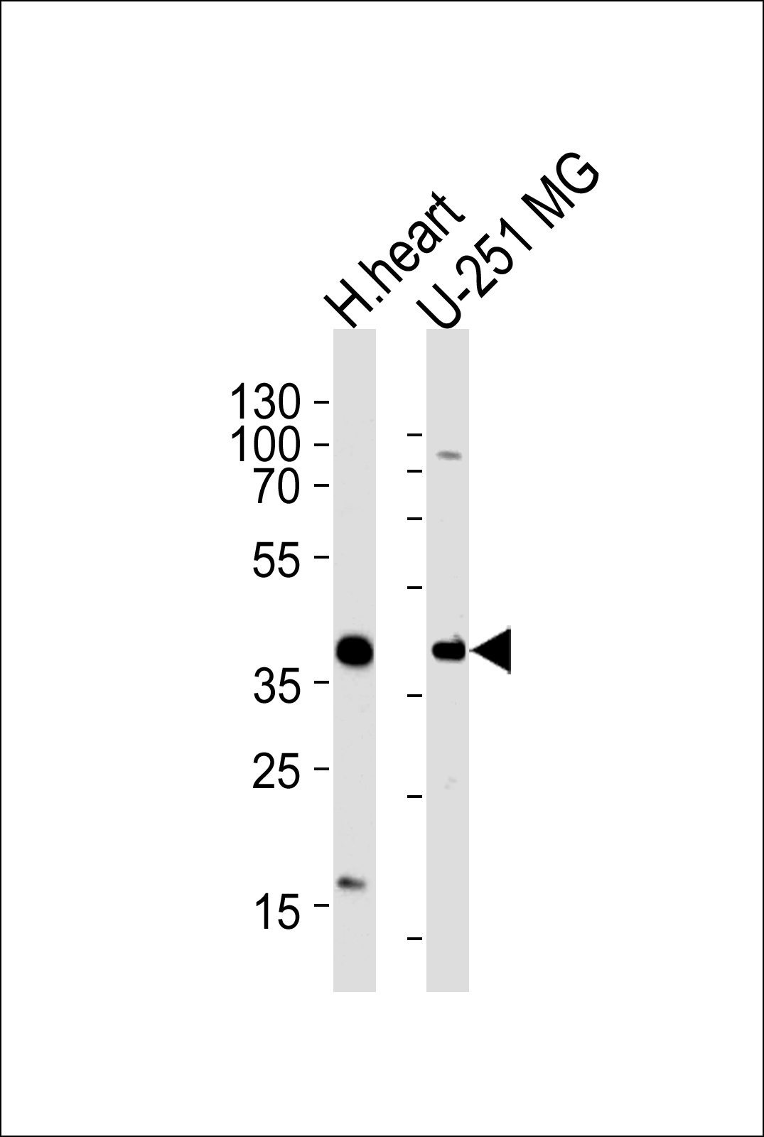 Rabbit Polyclonal Antibody to AKTIP(C-term)