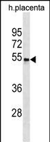Rabbit Polyclonal Antibody to CCKAR(Center)