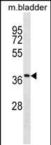Rabbit Polyclonal Antibody to Mouse Tmem158(Center)