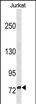 Rabbit Polyclonal Antibody to ZNF274(N-term)
